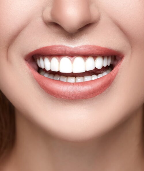 types-of-loose-teeth