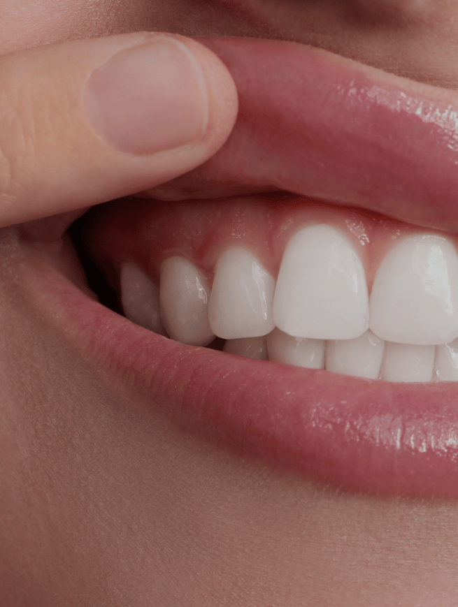 Denmark Street General Treatment Category